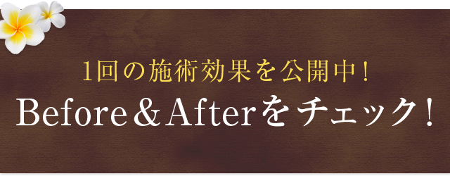 1回の施術効果を公開中！Before&Afterをチェック！