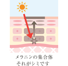 メラニンの集合体 それがシミです