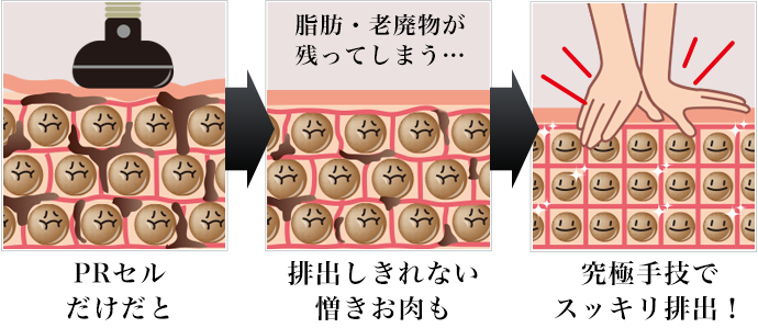 PRセルだけだと排出しきれない憎きお肉も究極手技でスッキリ排出！